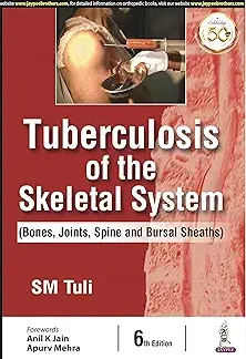 Tuberculosis of the Skeletal System (Bones, Joints, Spine and Bursal Sheaths)- Tuli